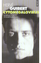 Cytomegalovirus. journal d-hospitalisation